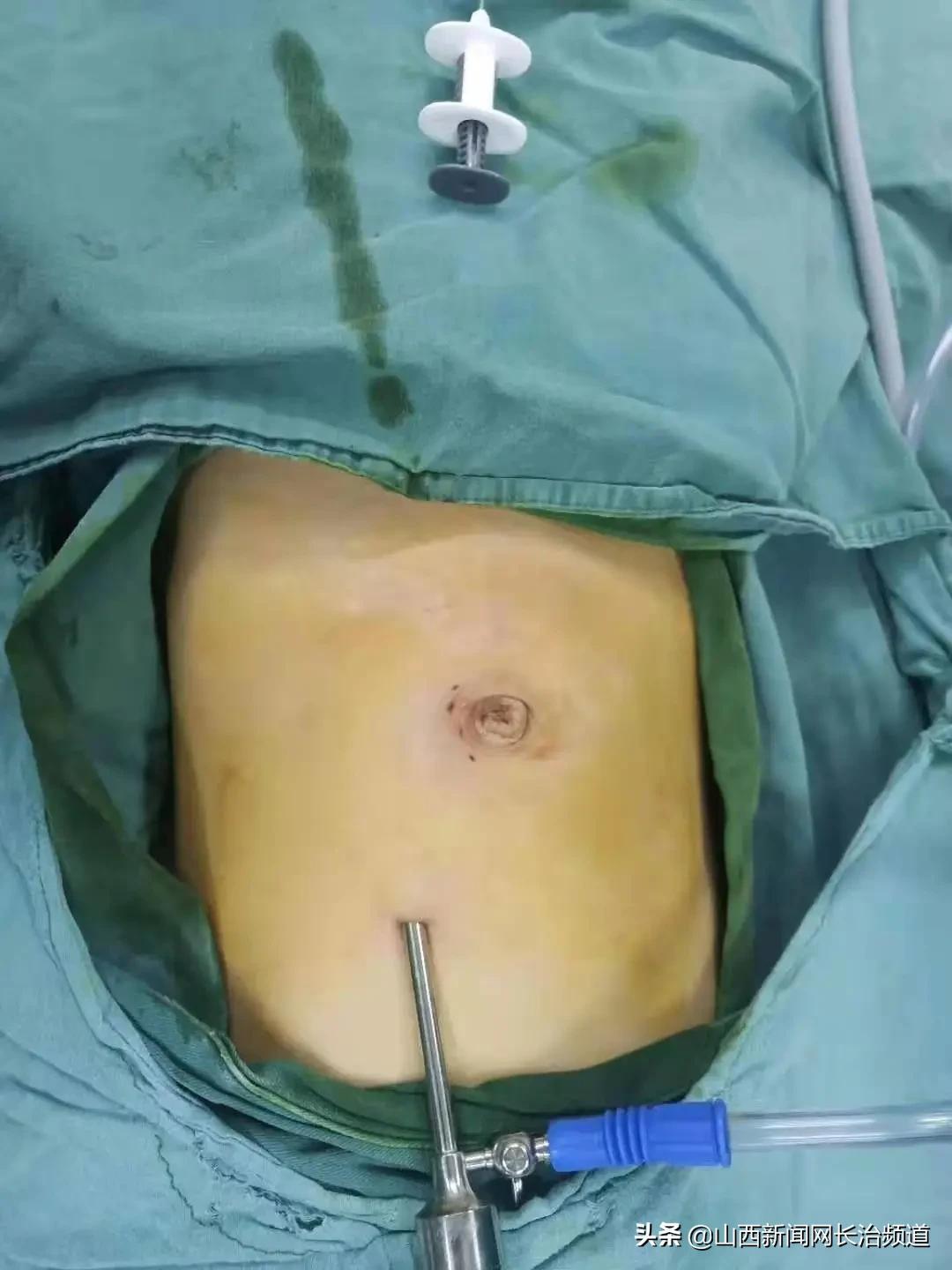 什么樣的疤痕不能當(dāng)兵？深入了解征兵體檢中的疤痕要求，征兵體檢中的疤痕要求，哪些疤痕影響入伍資格？