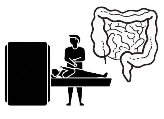 腸癌的早期癥狀及其識別重要性，腸癌早期癥狀識別與重要性探討