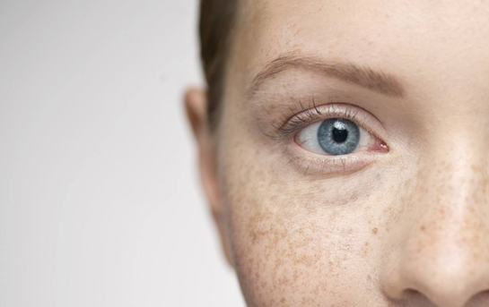 如何判斷臉上是什么斑——圖片輔助解析，臉上斑點(diǎn)的判斷與識(shí)別，圖片輔助解析指南