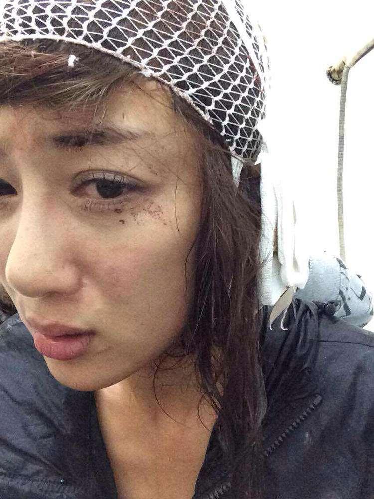 明星整容毀容最嚴(yán)重的是誰(shuí)，深度探討與反思，深度探討與反思，哪位明星整容遭遇最慘重的毀容？