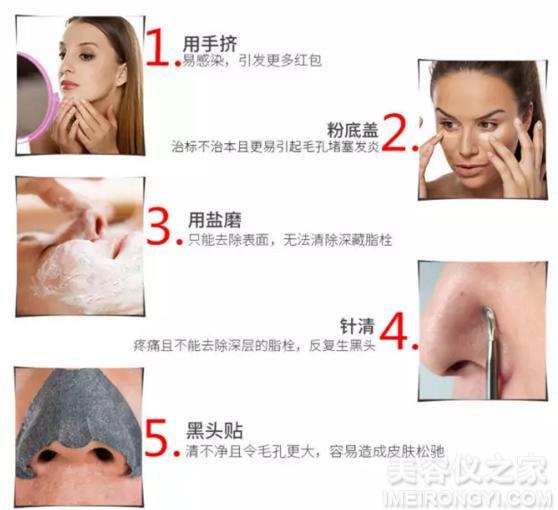 去黑頭的簡單小妙招，去黑頭小妙招分享，輕松告別黑頭困擾