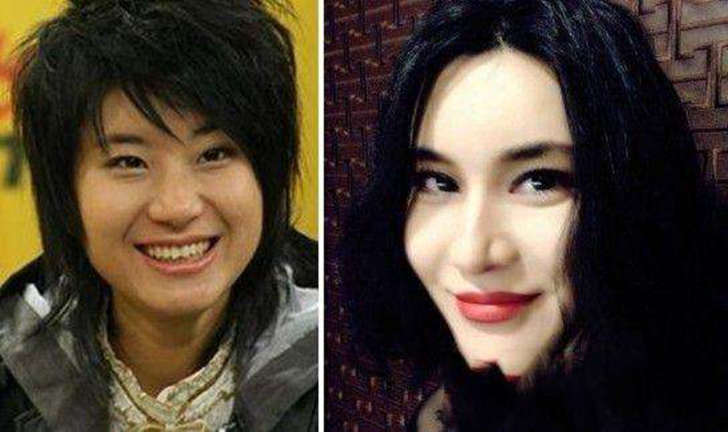 整容整丑了的明星，審美變遷下的遺憾案例，審美變遷下的明星整容遺憾案例，從美到丑的遺憾經(jīng)歷