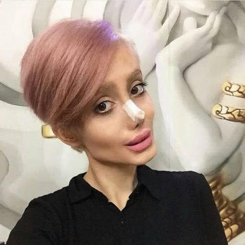 整容最瘋狂的女人，背后的故事與心理探索，整容狂熱背后的女人故事與心理揭秘