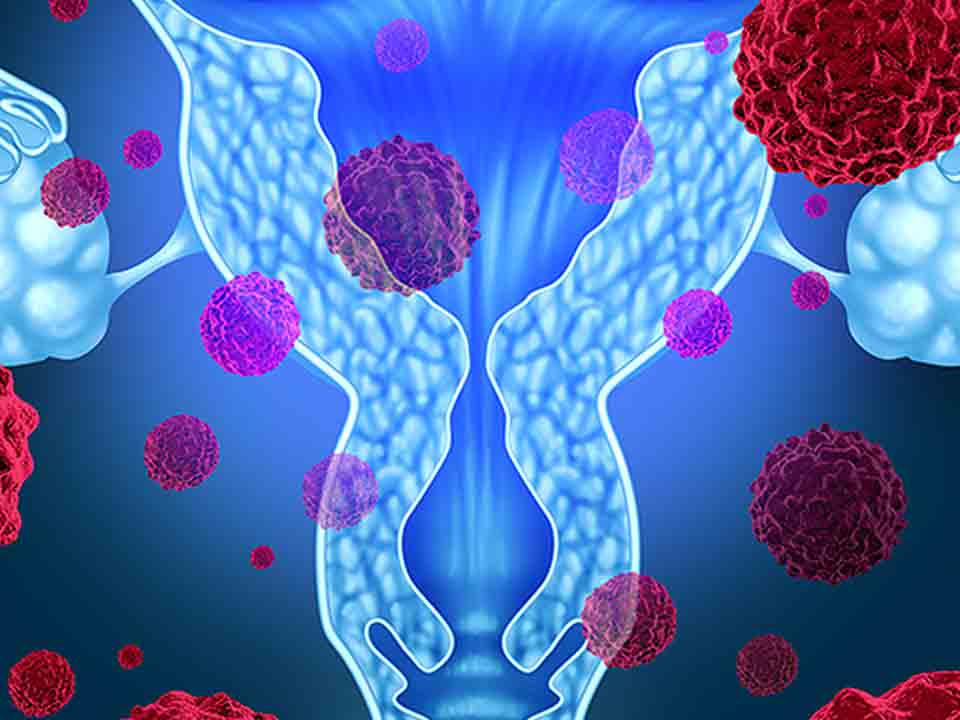 尖銳濕疣會自愈嗎？深入了解尖銳濕疣及其治療，尖銳濕疣能否自愈？全面解析尖銳濕疣及其治療方法