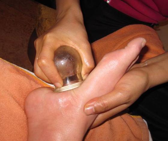 拔火罐對腎虛有好處嗎？深度解析傳統(tǒng)療法與現(xiàn)代健康理念，拔火罐對腎虛的益處解析，傳統(tǒng)療法與現(xiàn)代健康理念融合探索