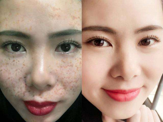 淡斑效果最好的產(chǎn)品與方法，安全與效果的完美結(jié)合，淡斑最佳產(chǎn)品與方法，安全效果完美結(jié)合之選