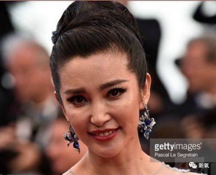 激光去眼袋能維持幾年，全面解析與你的期望相匹配，激光去眼袋效果能維持多久？全面解析滿足你的期望