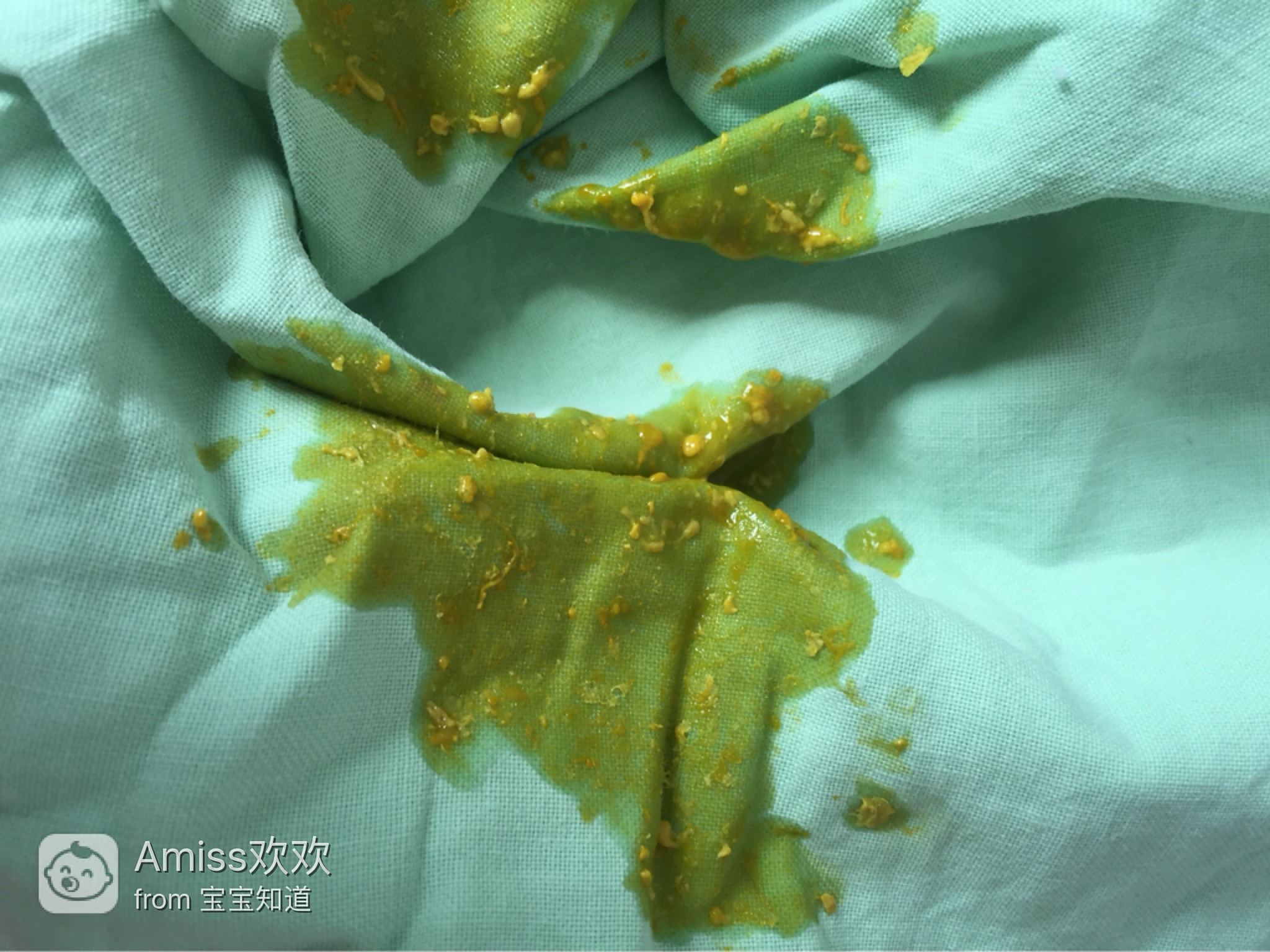 十來天的嬰兒老是拉稀怎么辦？全面解析寶寶腹瀉應對之策，嬰兒腹瀉應對指南，全面解析寶寶拉稀怎么辦？