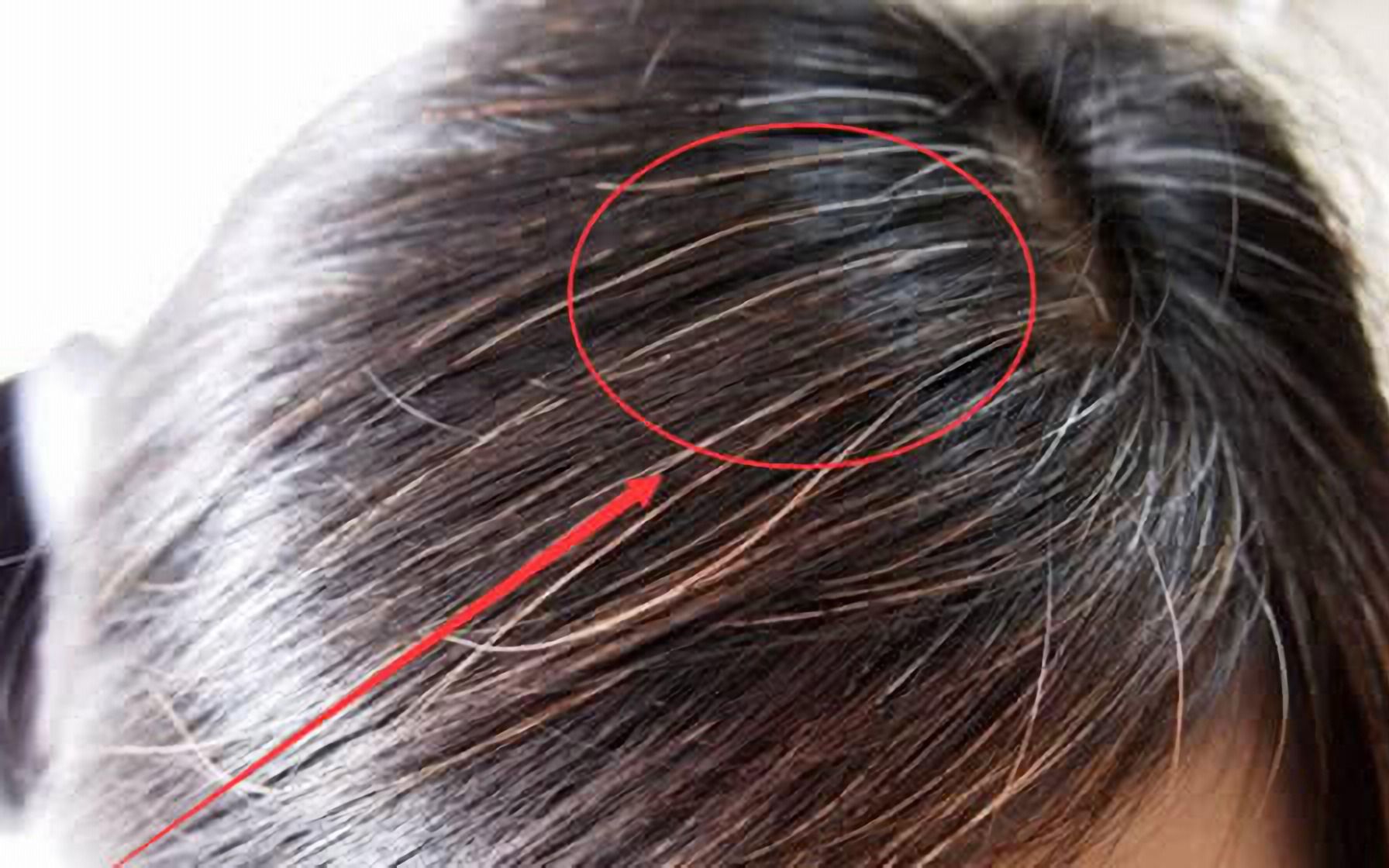 飛機打多了白頭發(fā)多怎么辦——探索原因與解決方案，飛機打多了導致白發(fā)增多，原因與解決方法探索