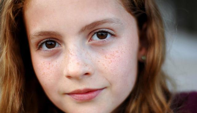 如何簡單有效去色斑？全面解析色斑問題，讓你重拾肌膚光彩，全面解析色斑問題，簡單有效去色斑，重拾肌膚光彩之道