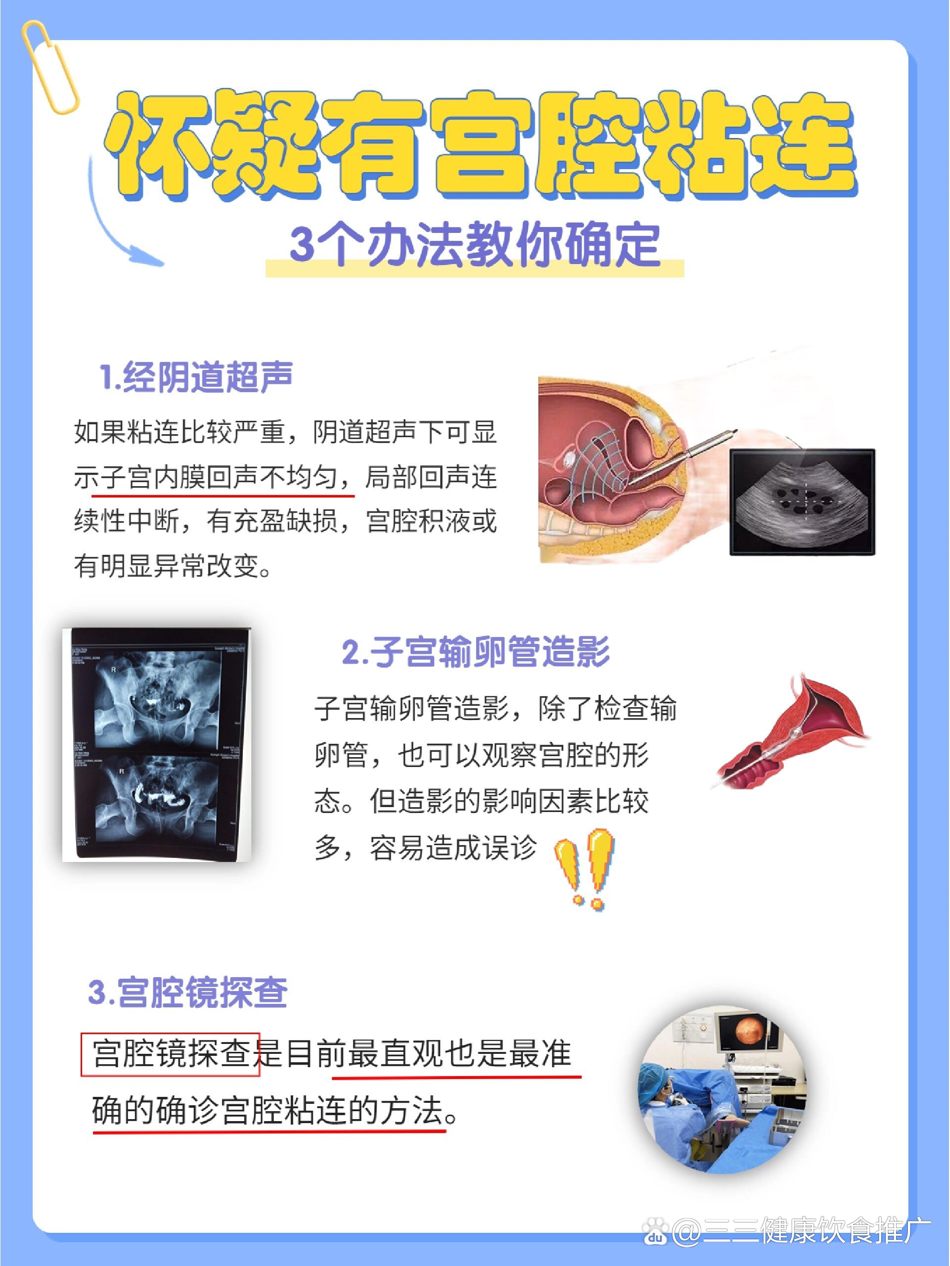 宮腔粘連自檢方法及其重要性，宮腔粘連自檢方法及其重要性解析