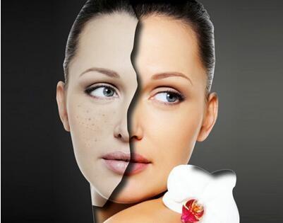 如何祛斑，探索最有效的祛斑方法，探索最有效的祛斑方法，告別斑點(diǎn)困擾！