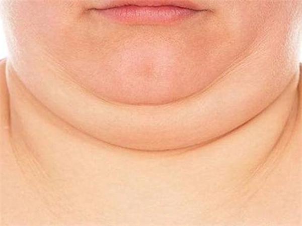 如何有效去除雙下巴贅肉——實用指南，實用指南，如何有效去除雙下巴贅肉