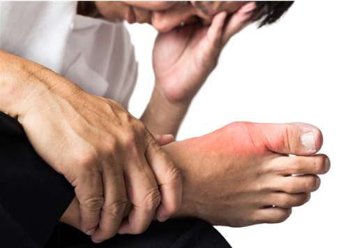 降低尿酸高，飲食調(diào)整與天然食物選擇，飲食調(diào)整與天然食物選擇助力降低尿酸高