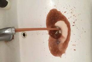 拉稀水是什么原因——深度解析腸道健康與疾病成因，拉稀水的原因深度解析，腸道健康與疾病成因探究