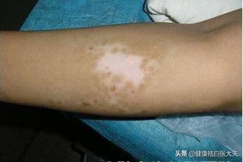 維生素C的益處，健康生活的秘密武器，維生素C的奧秘，健康生活的秘密武器