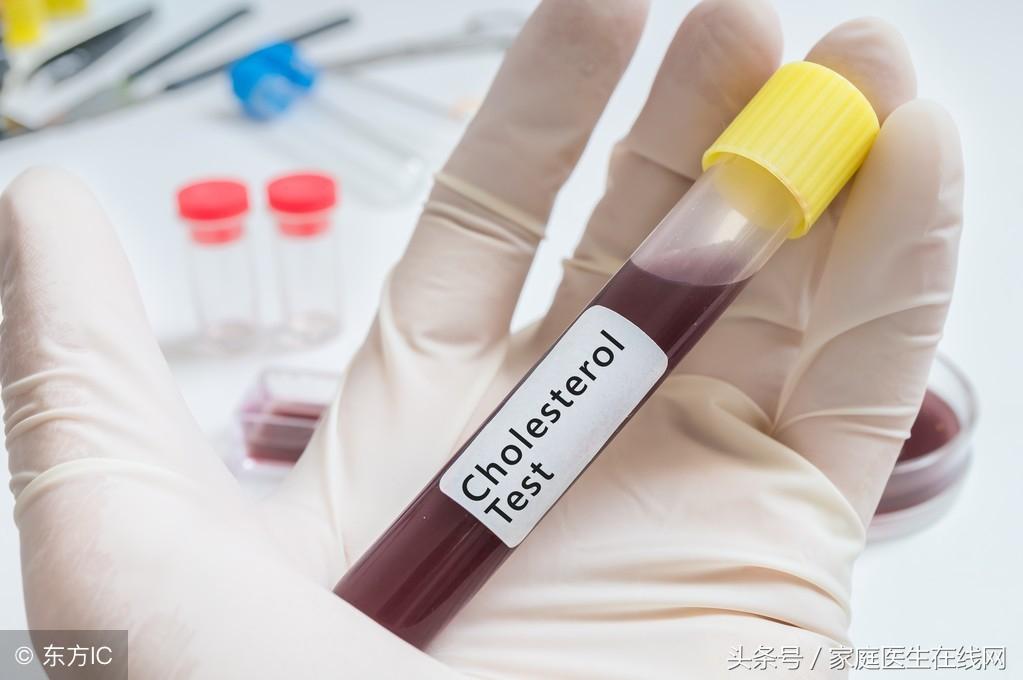 糖尿病的成因，深度解析其背后的原因，深度解析糖尿病成因，揭示背后原因真相