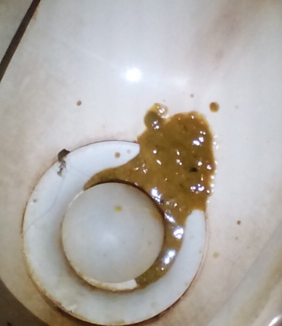 長期拉稀，原因、影響及改善策略，長期拉稀的原因、影響及改善策略