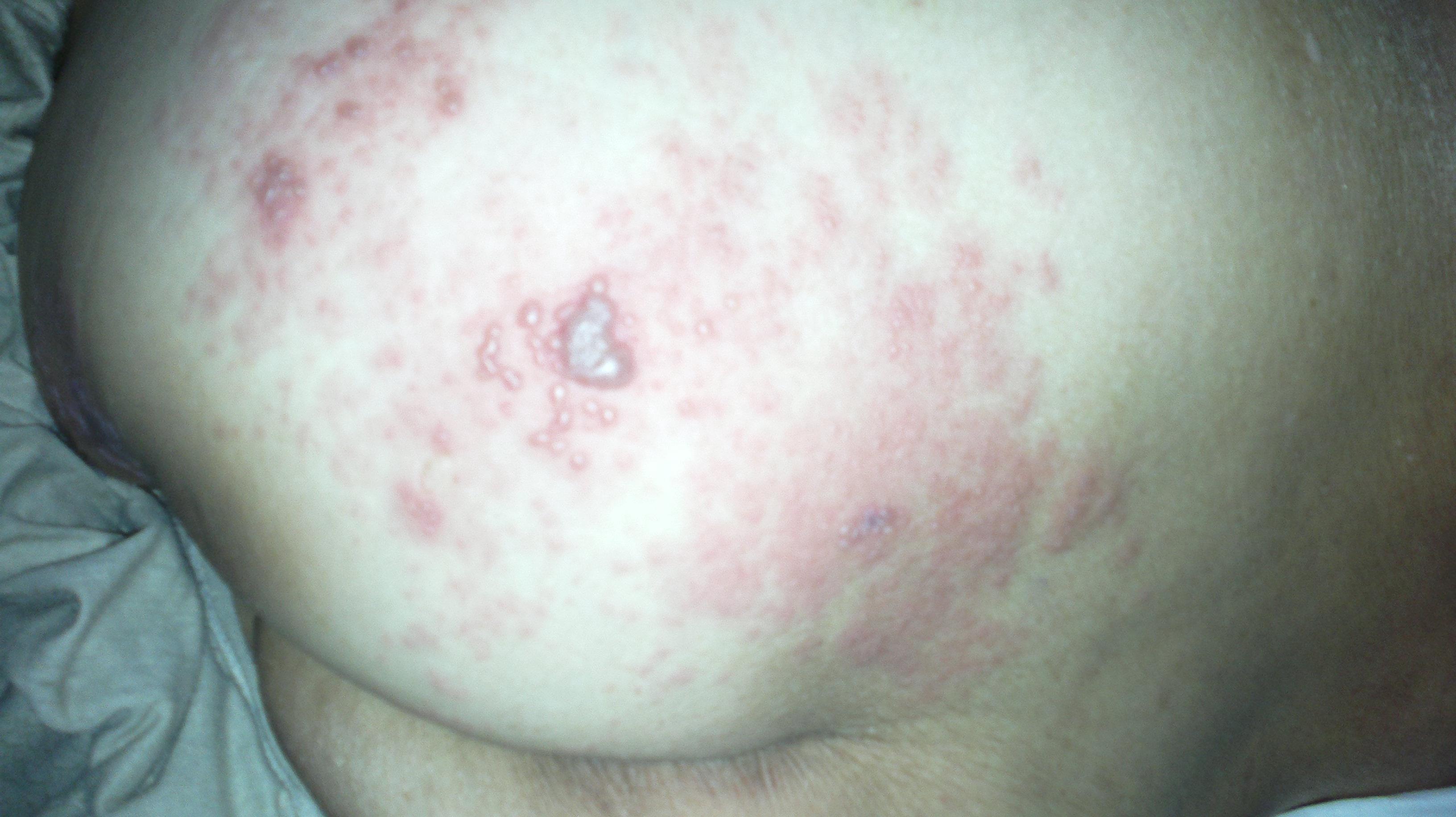 應該如何治療——全方位解析治療方法，全方位解析，疾病治療方法詳解