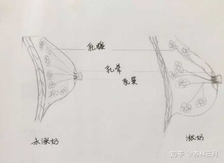 乳房硬塊消除，了解成因與應對方法，乳房硬塊消除，成因解析與應對方法指南