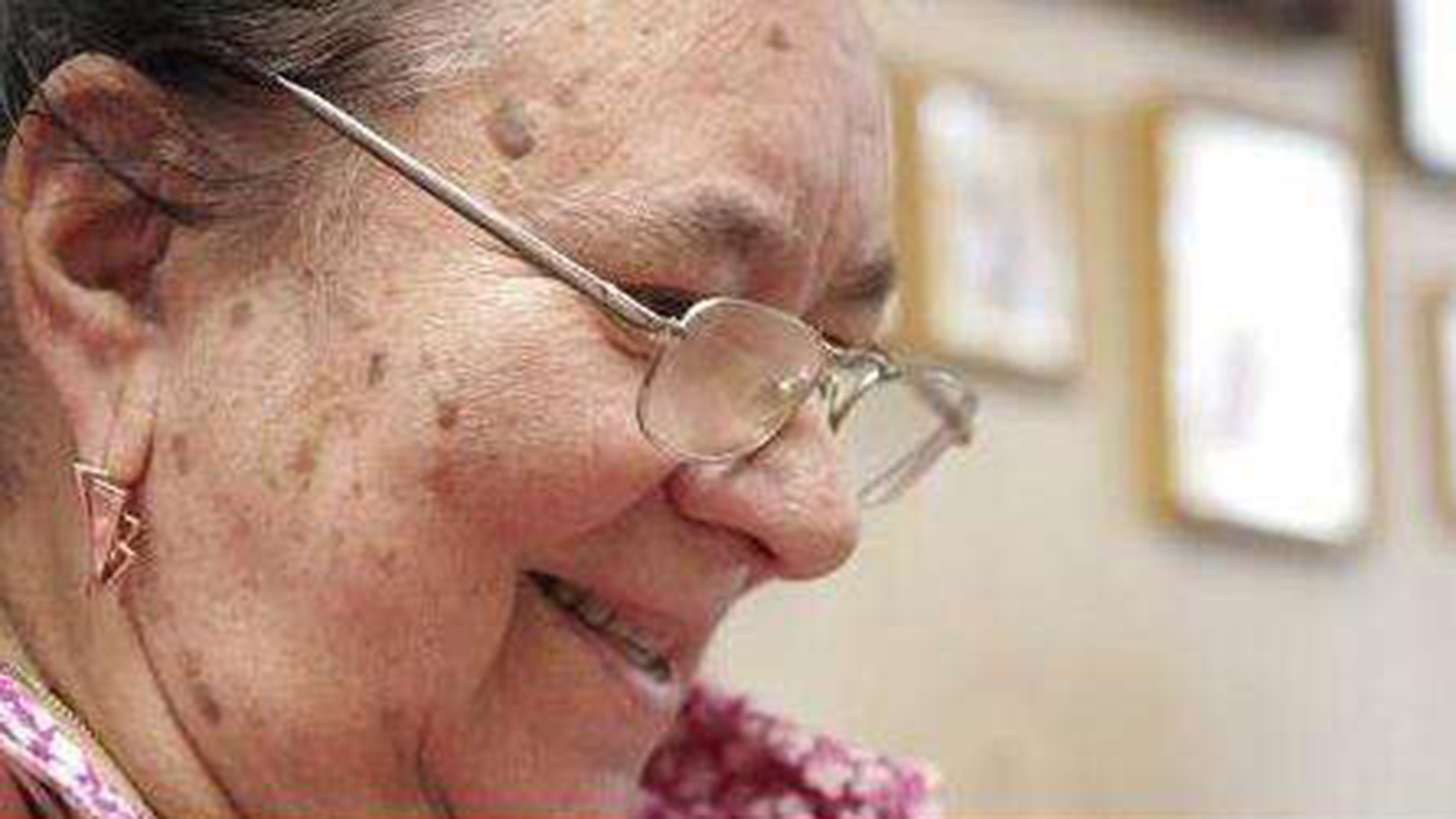 去老年斑點(diǎn)的最好方法——全面解析有效的護(hù)膚策略，去老年斑點(diǎn)的最佳方法，全面有效的護(hù)膚策略解析