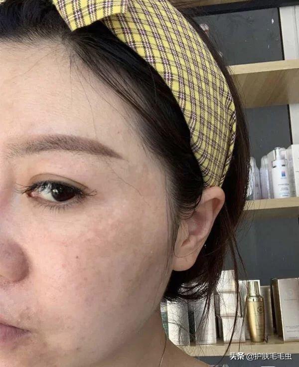 怎樣有效的淡化黃褐斑——全方位美白祛斑攻略，全方位美白祛斑攻略，如何有效淡化黃褐斑