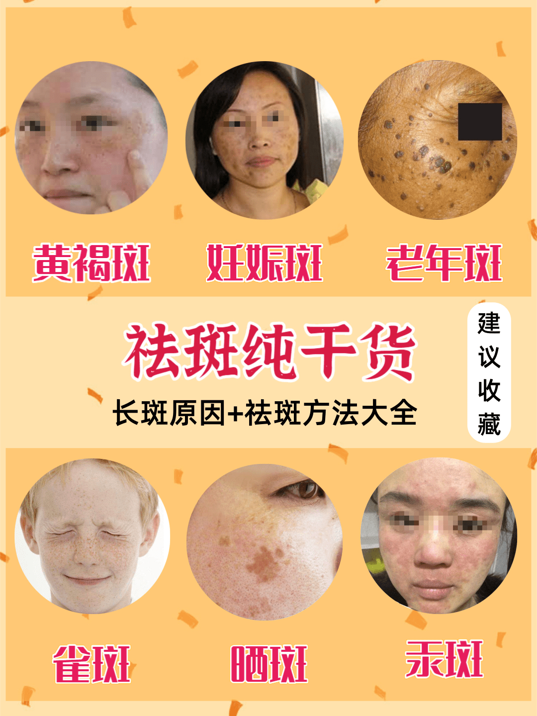 揭秘祛斑目前最有效的方法——打造無瑕肌膚，揭秘最有效的祛斑方法，打造完美無瑕肌膚