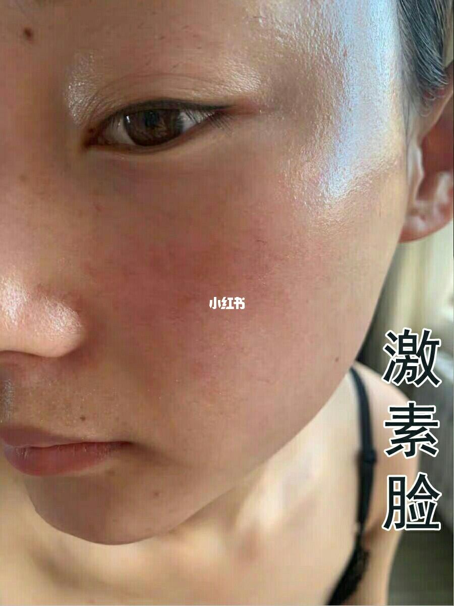 面部激素臉圖片及其相關(guān)問題解析，面部激素臉圖片解析及相關(guān)問題探討